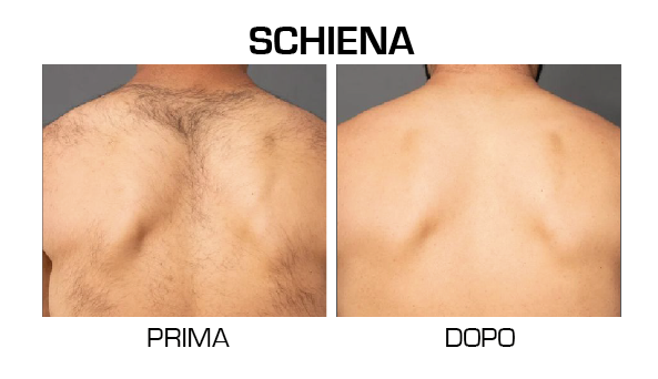 schiena